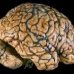 cerebro